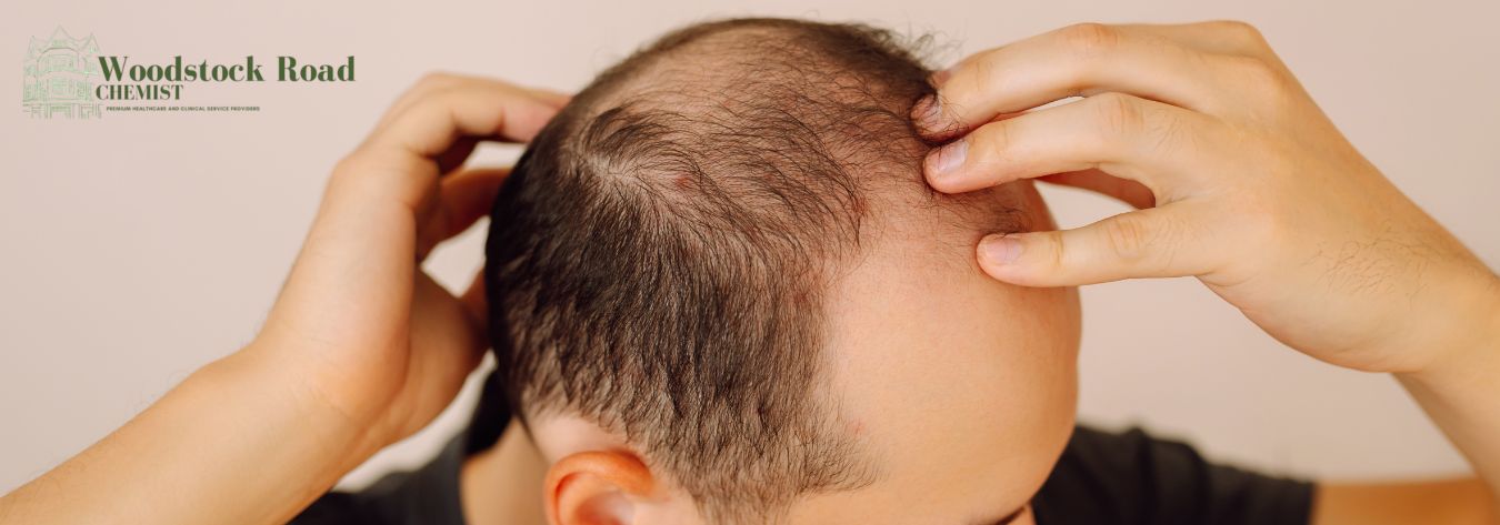 Hair loss Mae pattern baldness